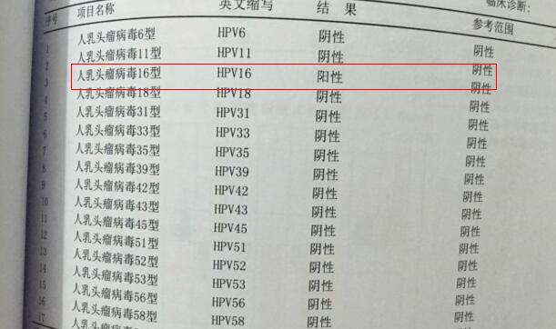 hpv,tct报告单全面解读,会看报告单,hpv便不可怕,附;转阴方法