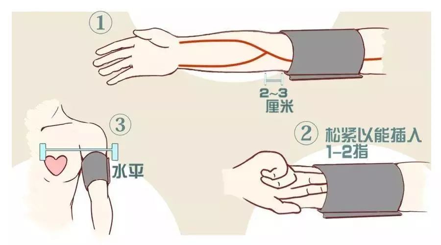袖带下缘距肘线2-3厘米; 松紧以能插入1-2指为宜; 问 如何记录血压?
