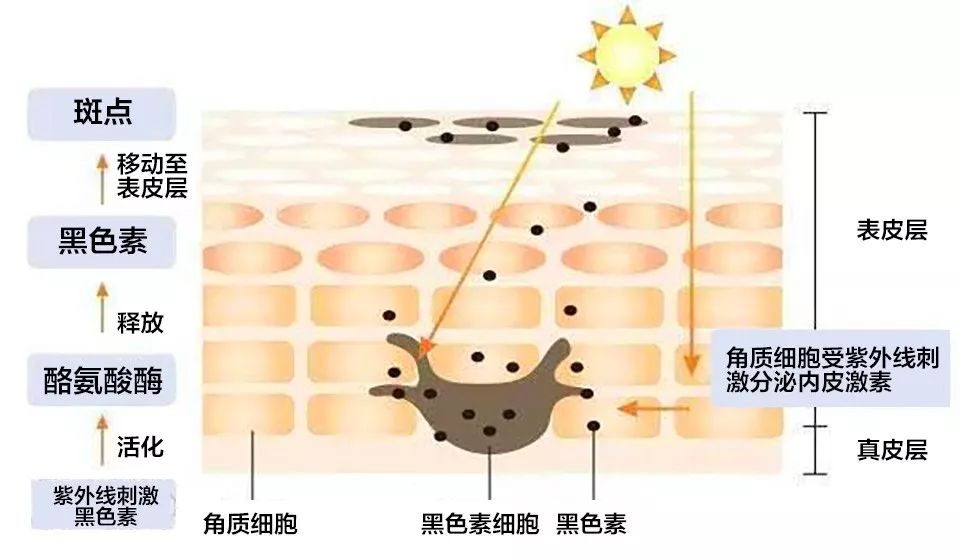 素颜老10岁!3个步骤分清黑眼圈类型