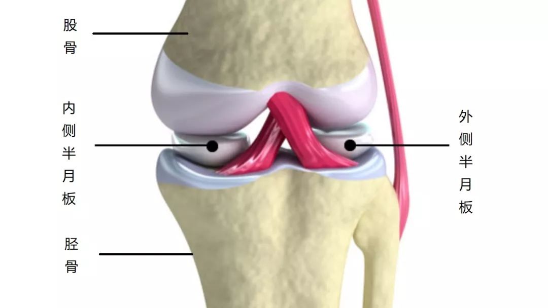 半月板是位于膝关节面介于股骨及胫骨之间的软骨,可分成内侧及外侧二