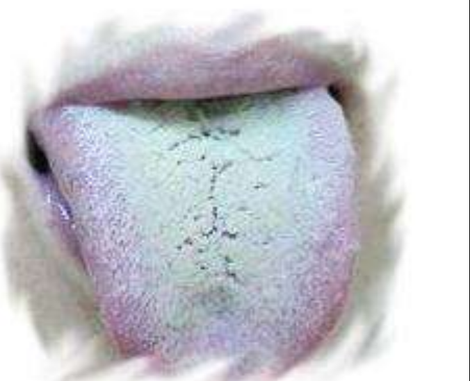 舌头的秘密:医生教你从舌头断疾病,从舌苔看健康
