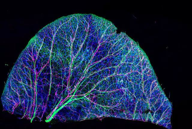 图片展示小鼠耳部皮肤的血管和神经网络,蓝色部分显示的是血管,绿色