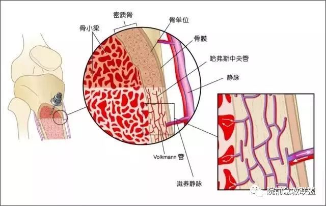 骨髓腔有着高度分化的血管结构,可以视为一种固定静脉用于大剂量液体