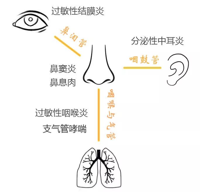 过敏性鼻炎能让孩子变丑 可别掉以轻心!