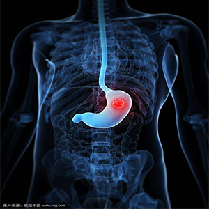 保胃健康 | 防患于"胃"然!警惕慢性胃炎的癌前病变