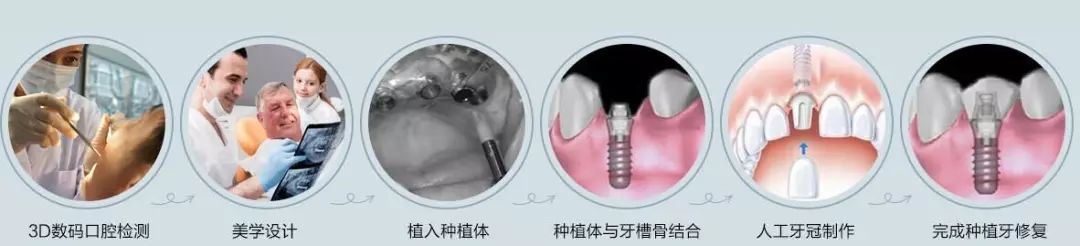 老牙掉了一半怎么办