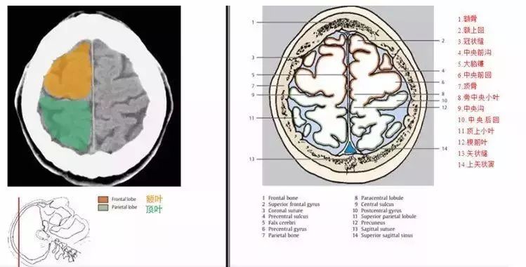 珍藏颅脑ct断面解剖彩色图谱