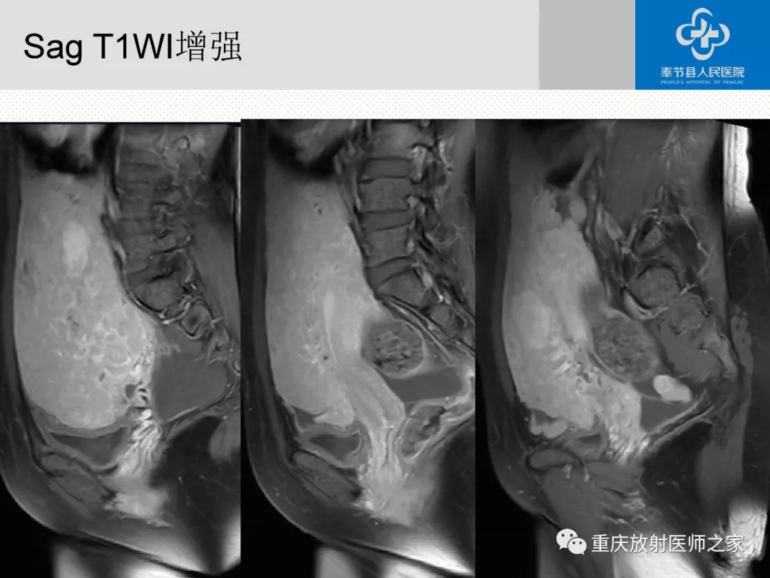 《ct/mri袖珍断层解剖图解》