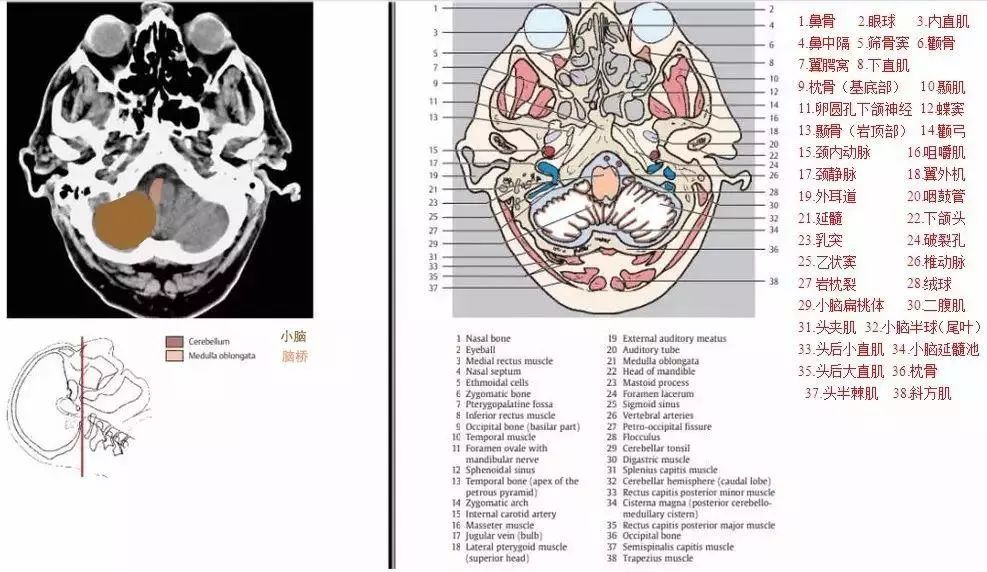 头颈部,胸,心,腹,盆腔五大部位可以放在口袋里的ct/mri解剖图解点击"