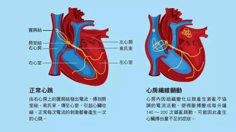 com/ 姓名:孙秀成教授 专业:心内科 心房颤动简称房颤,是常见的持续性