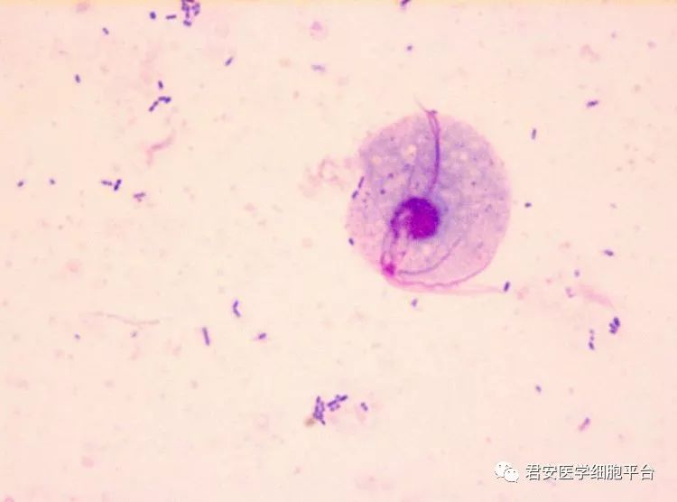 阴道毛滴虫染色心得分享