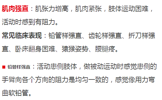 肌肉强直 齿轮样强直:患侧肢体同时伴有肢体颤抖