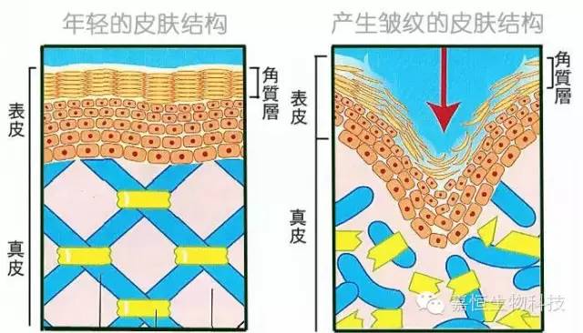 断裂缺失少的时候就是浅表性的皱纹,断裂缺失多的时候就形成了真皱纹