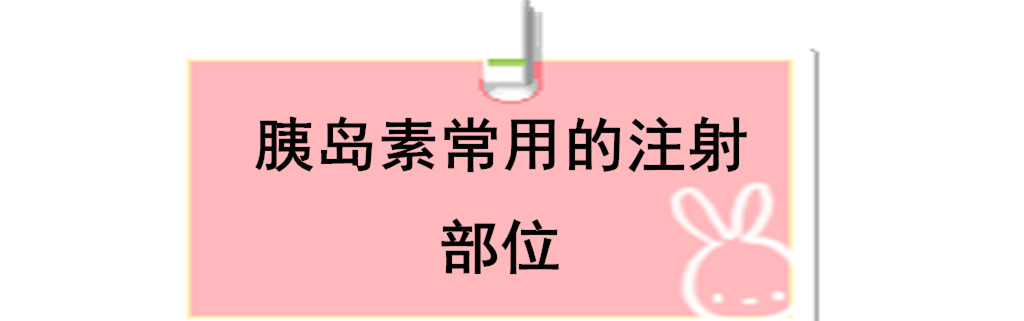 谁说胰岛素只能在肚子上注射?