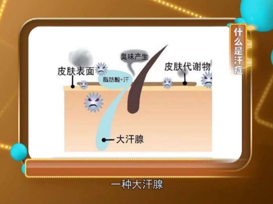 人体分布500亿个汗腺,用来调节体温.大汗淋漓,中医称之为汗症.