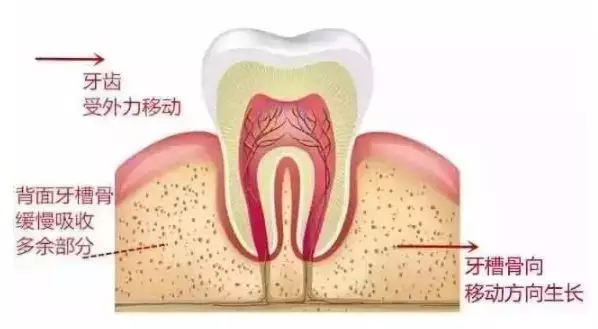 拔牙是利用什么原理_拔牙血凝块是什么样子(3)