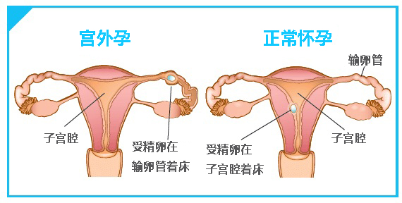 搭脉怎么测怀孕_自己摸脉怎么判断怀孕