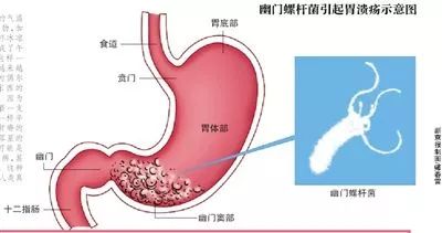 成人口中的变硬_正常宫颈口的图片