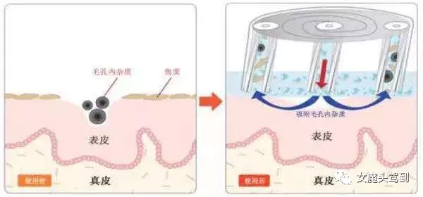 小汽泡的原理_韩国小气泡的原理及功效,小气泡多少钱一台 供应韩国小气泡的原理及功效,小气