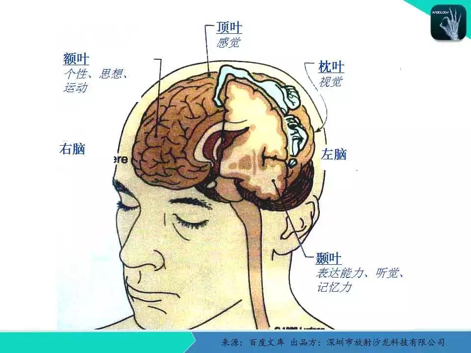 人脑与脑血管解剖分析