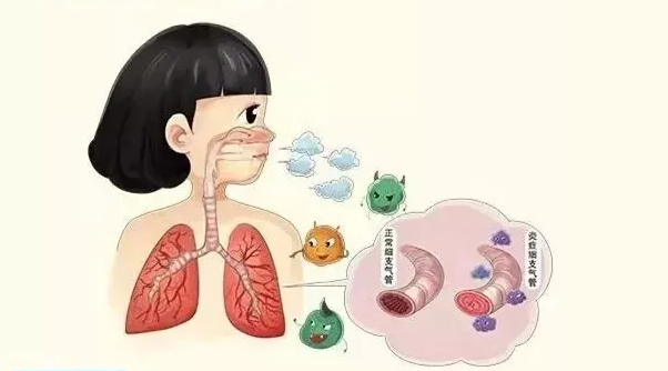 寒露已至,小心这3种慢性呼吸系统疾病!