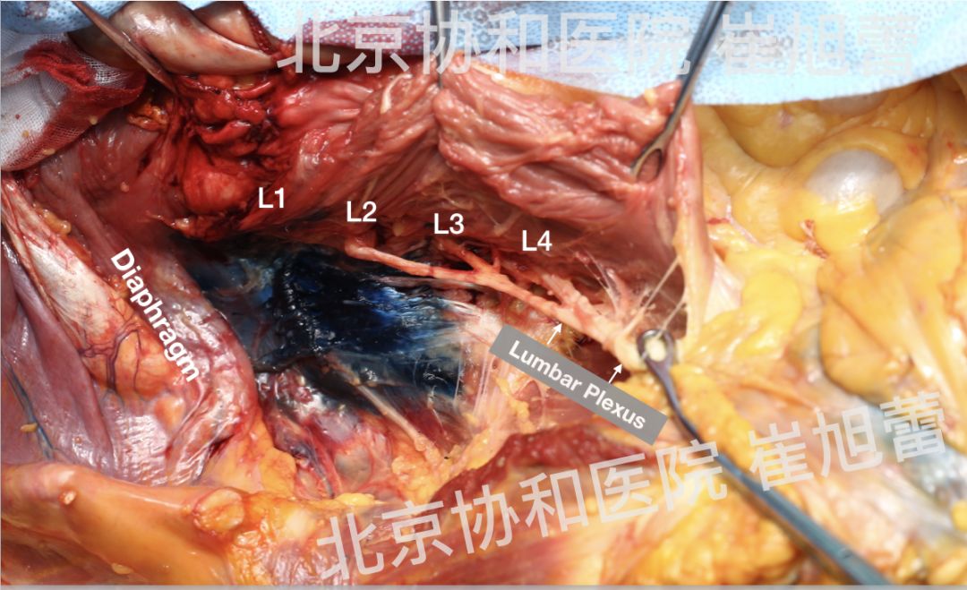 超声引导下腰方肌阻滞(下)