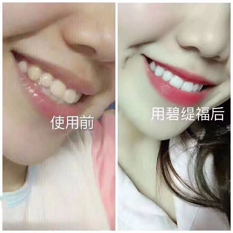 美牙仪牙托进水怎么办