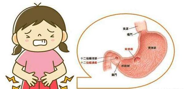 血清胃泌素水平下降,同时可发生胃粘膜萎缩;在患有胃泌素瘤的病人