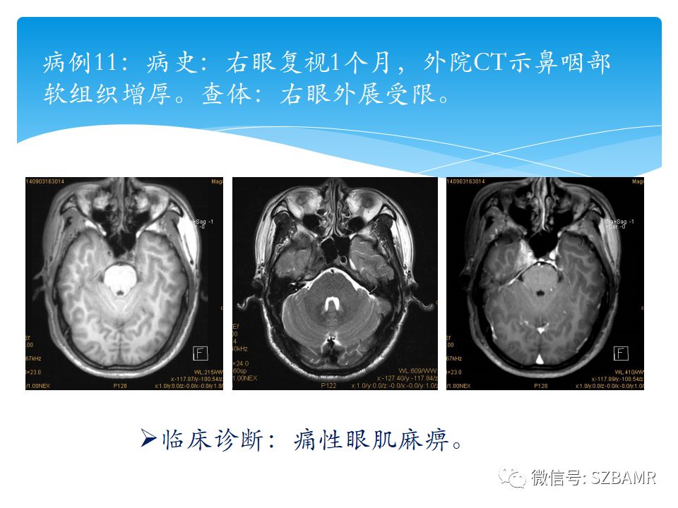 肝胆胰脏检查是什么原理_猪胰脏是什么器官图片(2)