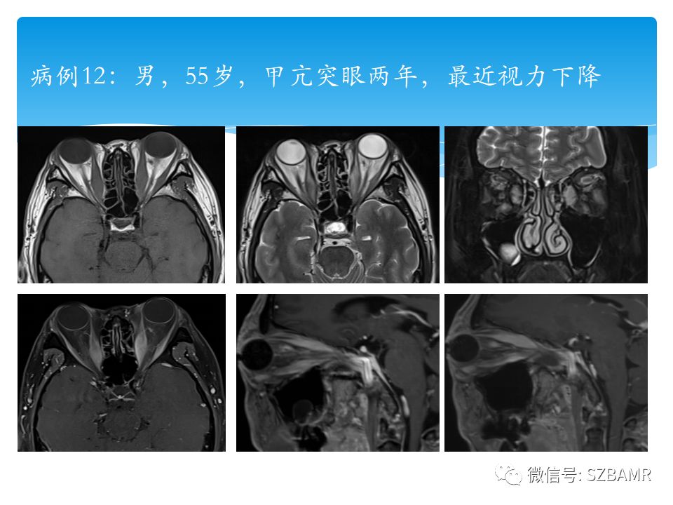 肝胆胰脏检查是什么原理_猪胰脏是什么器官图片(2)