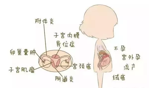 青春,生育,更年3个时期,超详细的"女性妇科疾病"地图