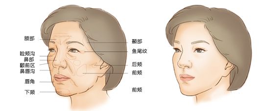 徒手整形什么原理_徒手整形颧骨失败照片(2)