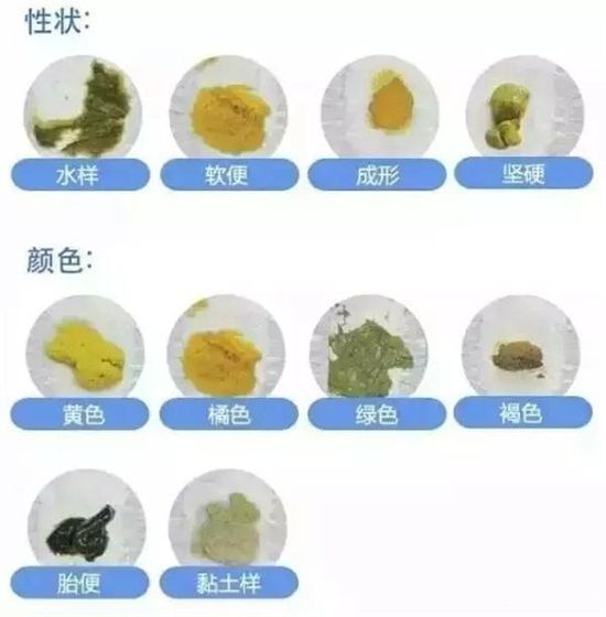 如果宝宝大便出现了这种颜色,可能是过度