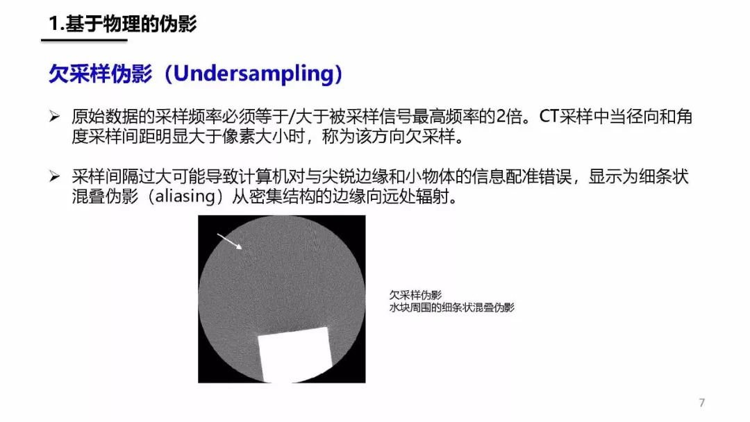 ct伪影产生机制及图像表现