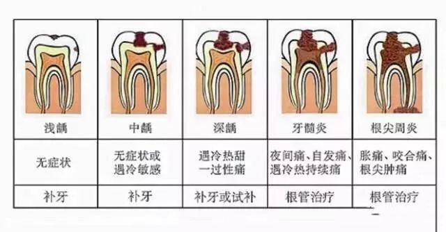 牙疼为什么会头疼