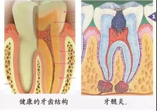 牙疼为什么会头疼