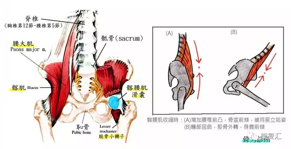 康复分享多了解髂腰肌症候群如何康复