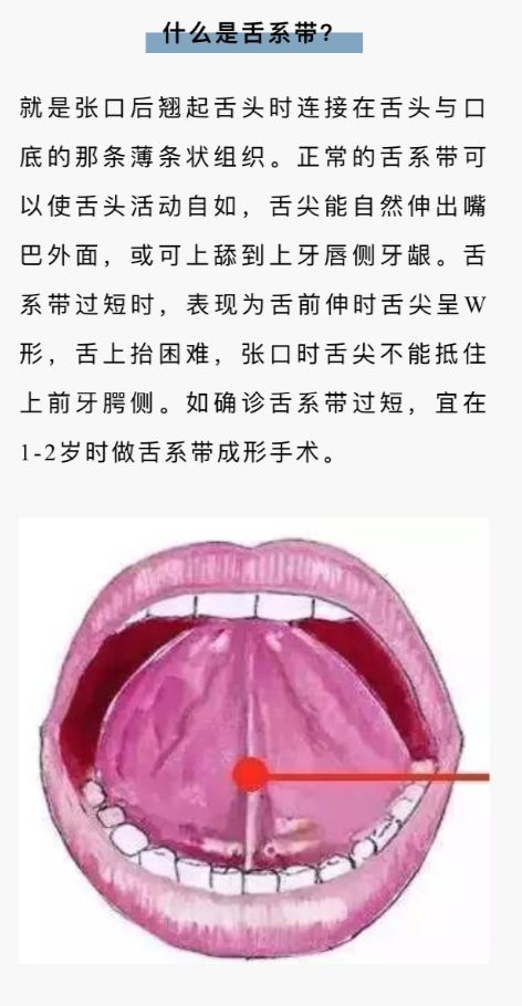 又让他试读了几个词语,一开始孩子读不准翘舌音,把"吃苹果"读成了"呲