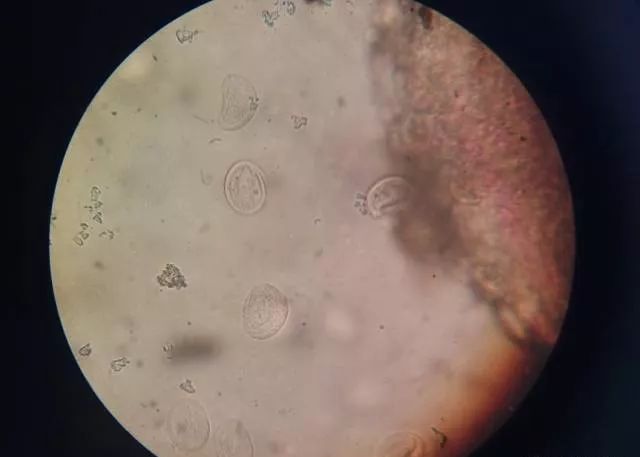 显微镜下寄生于鳃丝上的斜管虫
