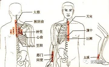 秋冬季节刮痧防治中风用刮痧