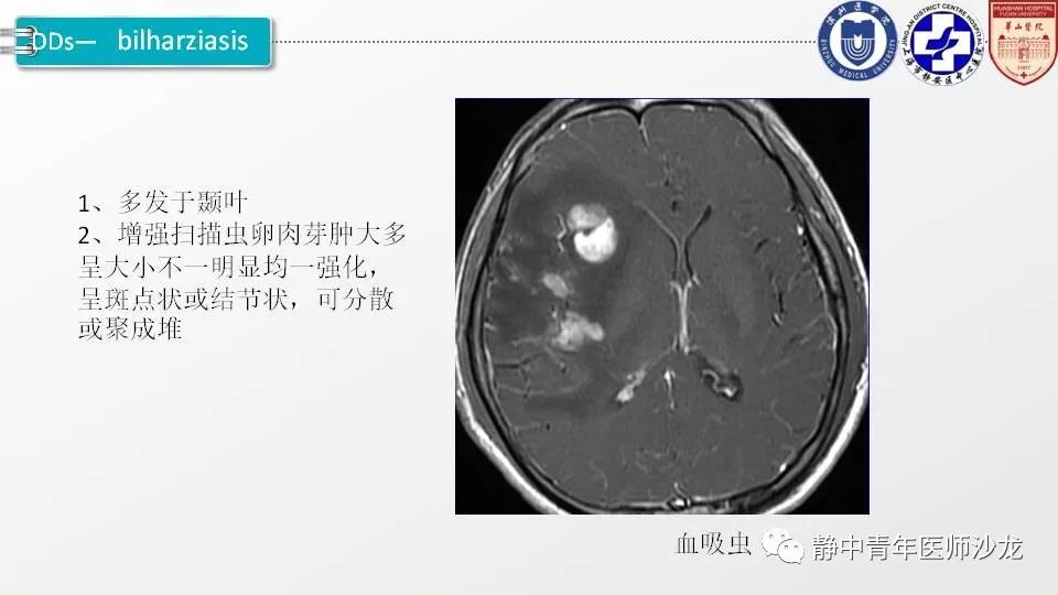 原创一例结核性脑膜炎病例的影像学分析