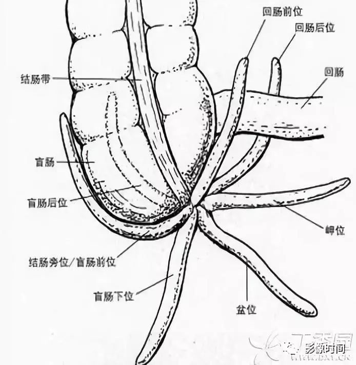 阑尾可位于盲肠后,盲肠下,回肠后,回肠前或盆腔内.