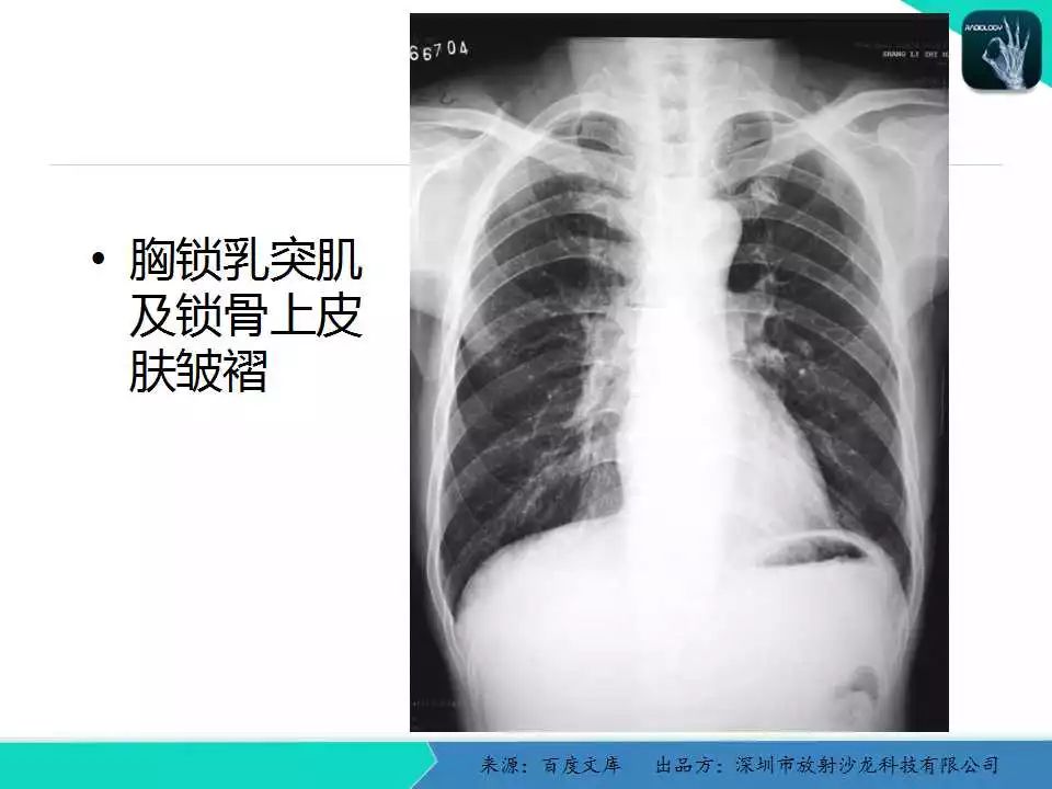 《中华医学影像技术学》数字x线成像技术卷权威的编者团队系统的学科