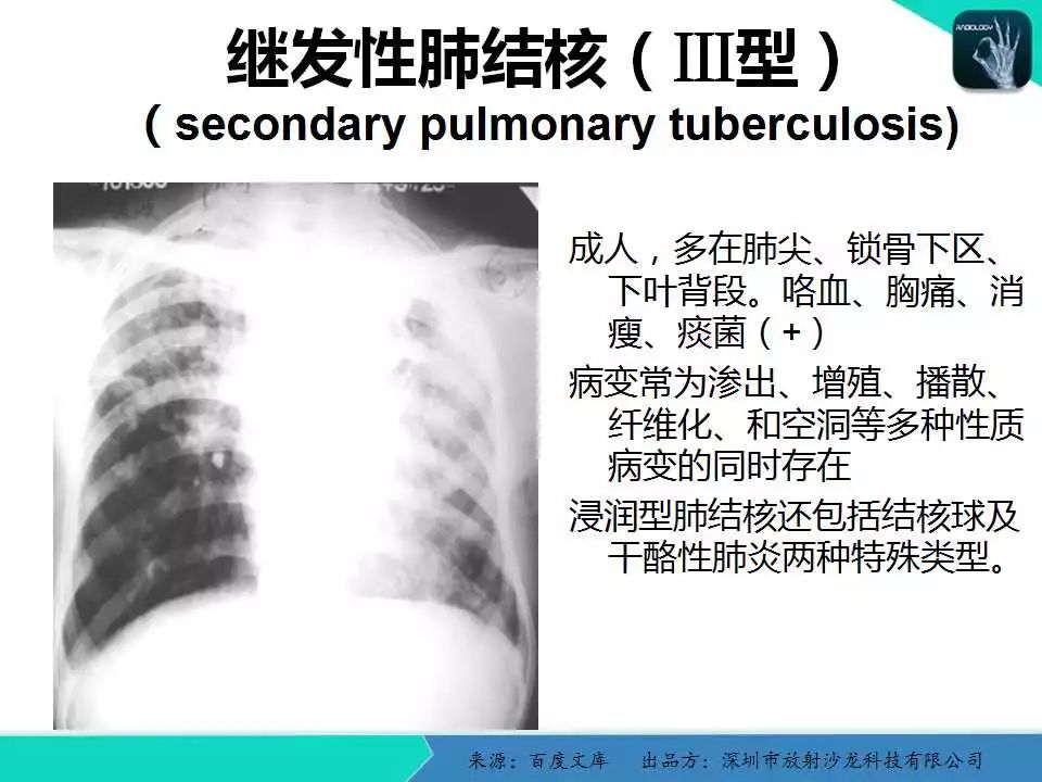 《中华医学影像技术学》数字x线成像技术卷权威的编者团队系统的学科