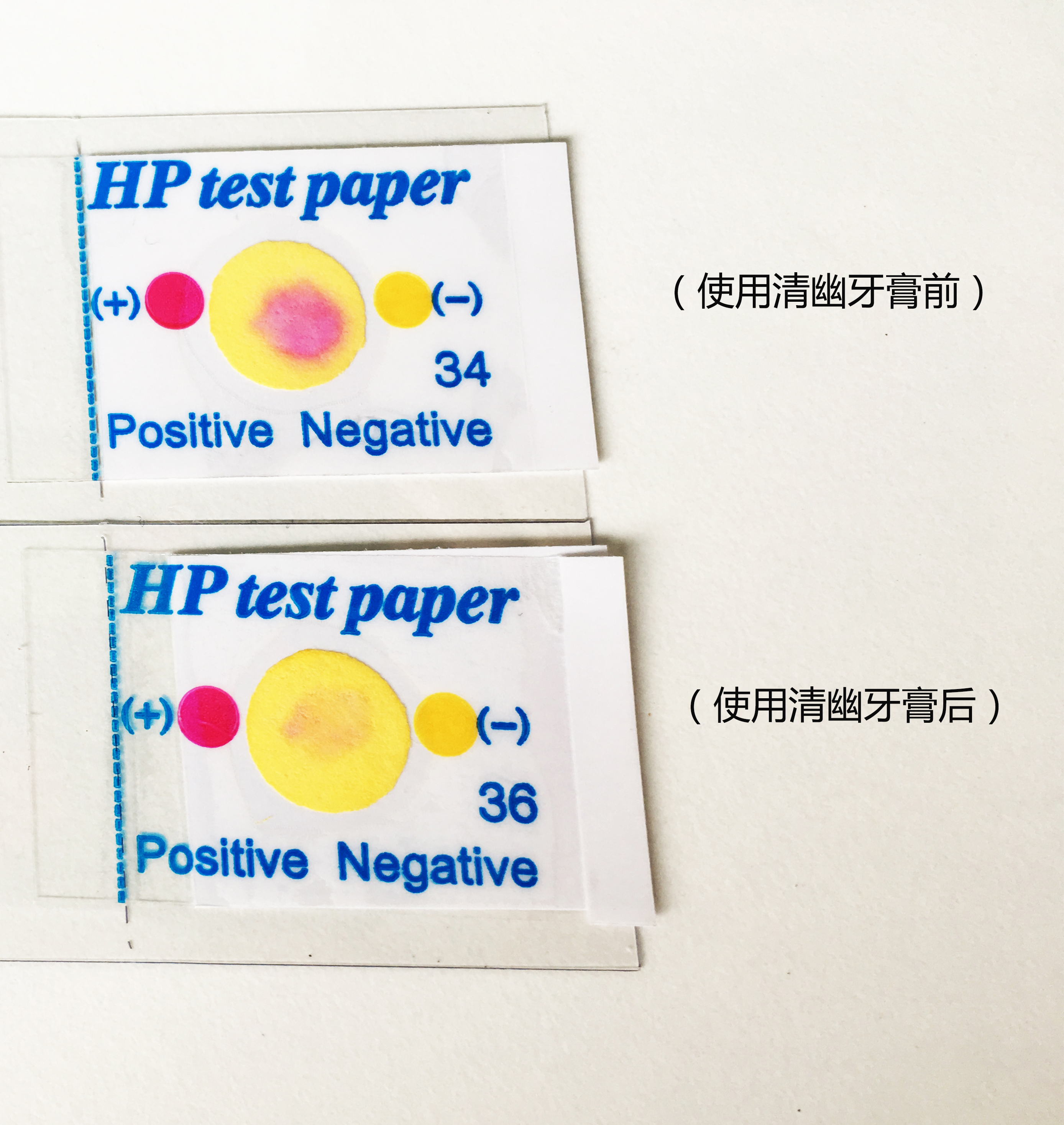 想要幽门螺旋杆菌根除一次成功?这个关键点一定不能忽视