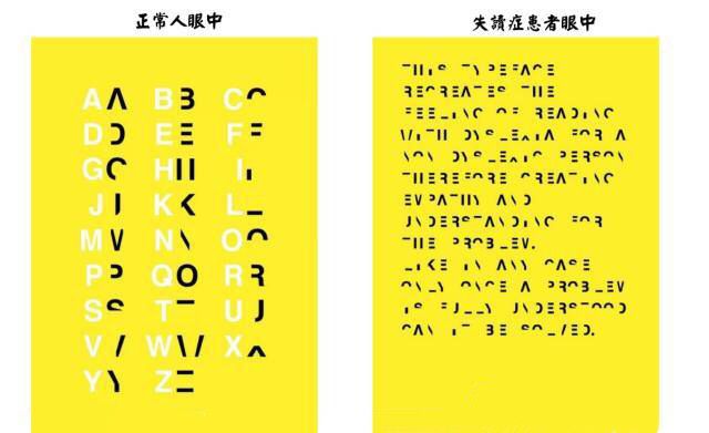 与大脑优势半球内测枕额脑回损害有关,并因累及视觉放射可致同侧偏盲