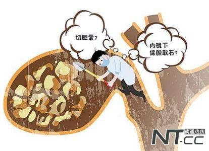 胆结石和胆囊癌到底有什么联系