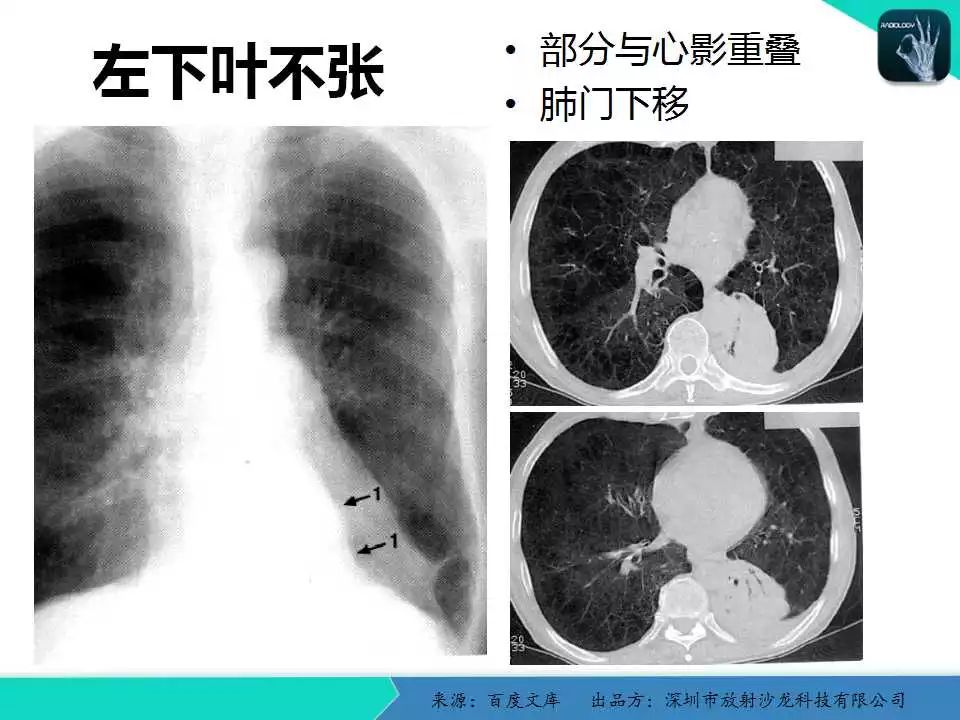 《中华医学影像技术学》数字x线成像技术卷权威的编者团队系统的学科