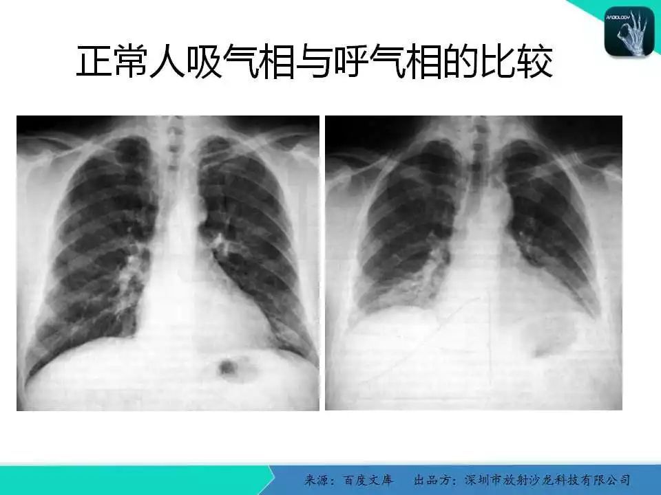 《中华医学影像技术学》数字x线成像技术卷权威的编者团队系统的学科