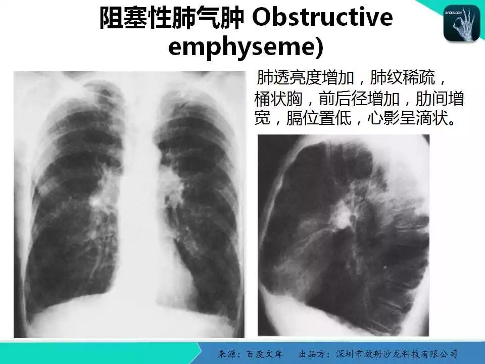 《中华医学影像技术学》数字x线成像技术卷权威的编者团队系统的学科